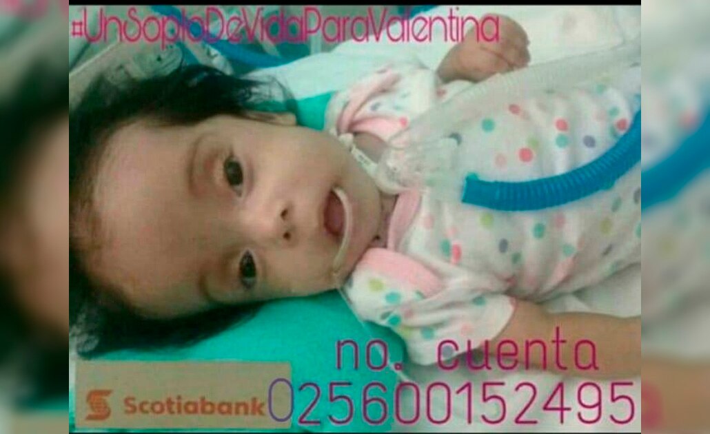 Servicio a la comunidad. Ayuda a Paula Valentina