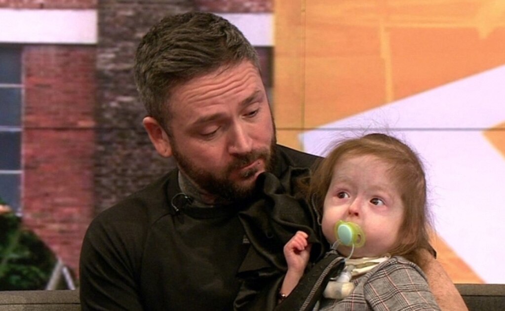 La niña de 2 años con una condición única que acelera su envejecimiento