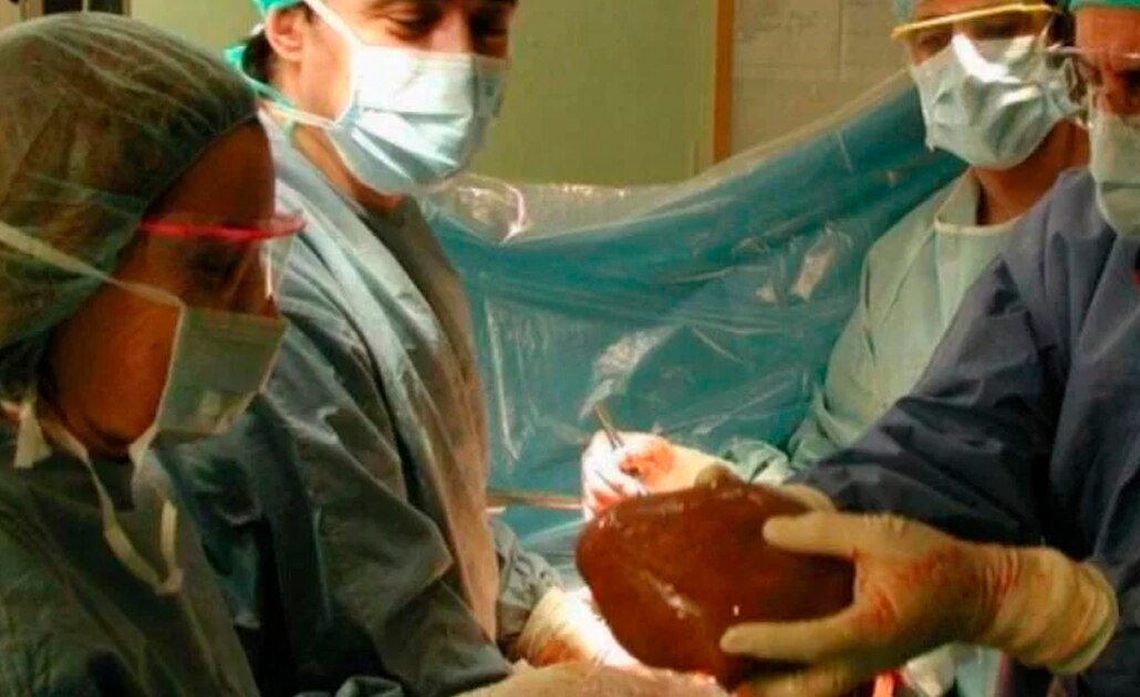 Probarán órganos de cerdos para trasplantes en humanos