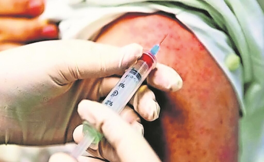 Caso importado de sarampión no debe causar alarma, señala sector salud 