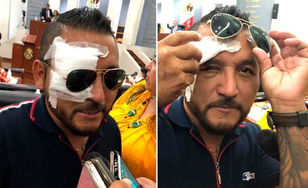 “El Mijis” denuncia nueva agresión