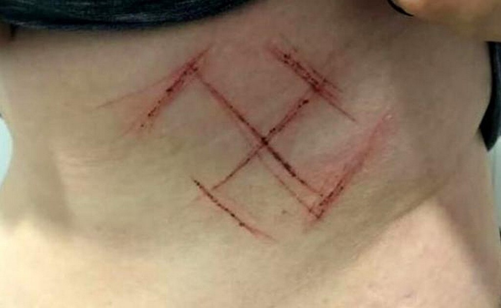 Esta imagen se difundió en redes sociales como correspondiente a la mujer que denunció la agresión. (Foto: Captura de pantalla)