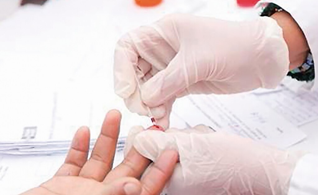 Recorte presupuestal afecta a asociaciones que apoyan labor contra el VIH