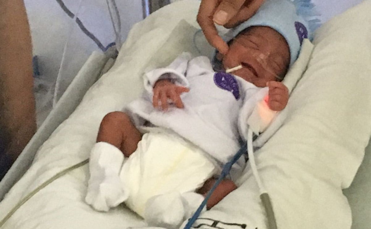 El bebé prematuro más pequeño del Hospital Central se aferra a la vida con una sonrisa