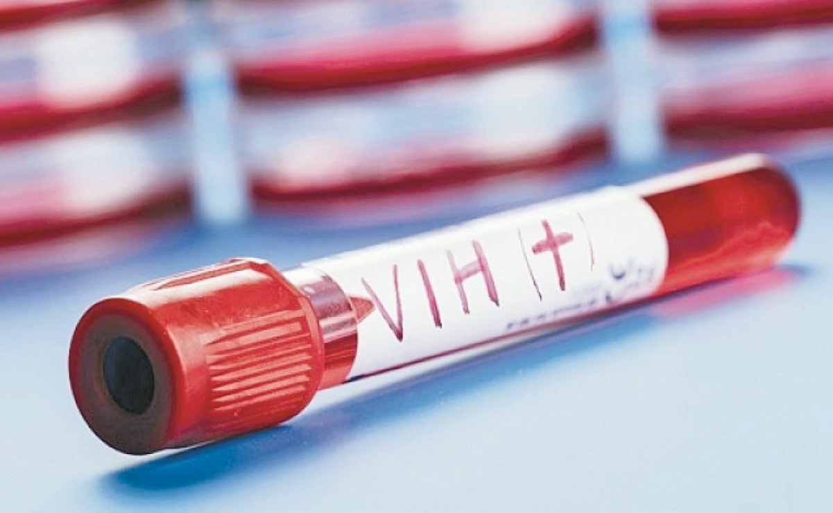 “No hay evidencia científica de que personas con VIH sean vulnerables al coronavirus”