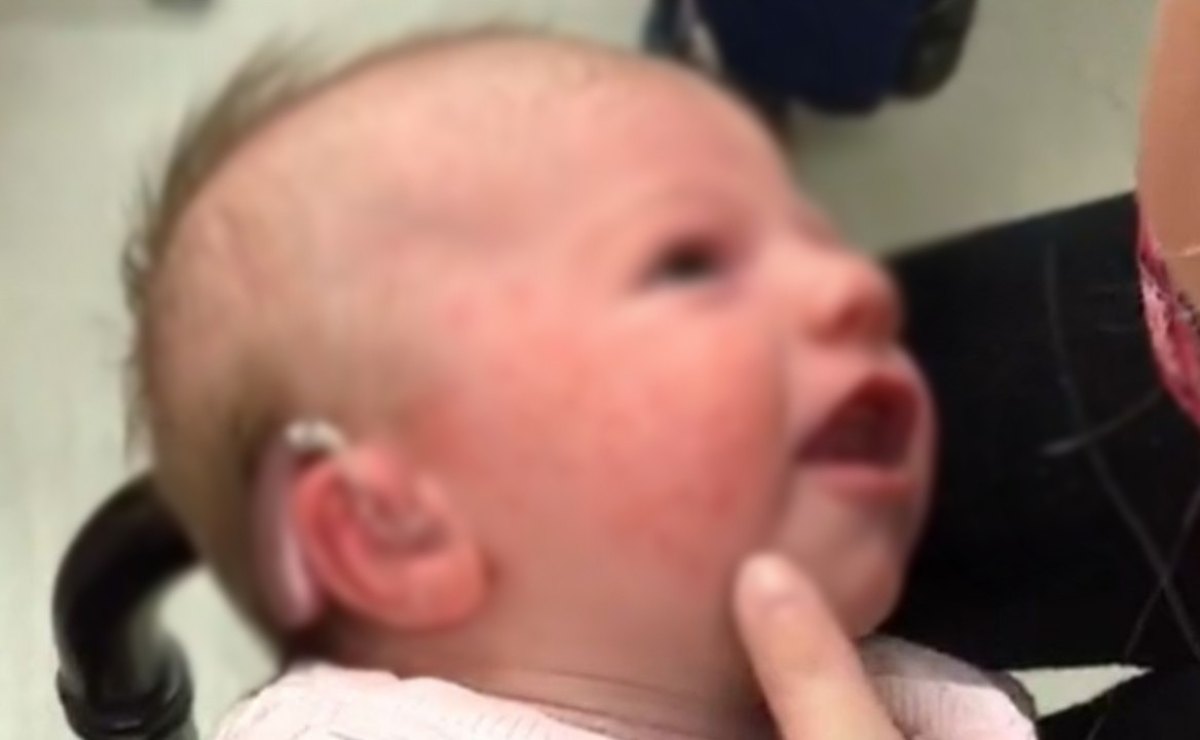 Viral: la emotiva reacción de una bebé sorda al escuchar la voz de su mamá por primera vez 