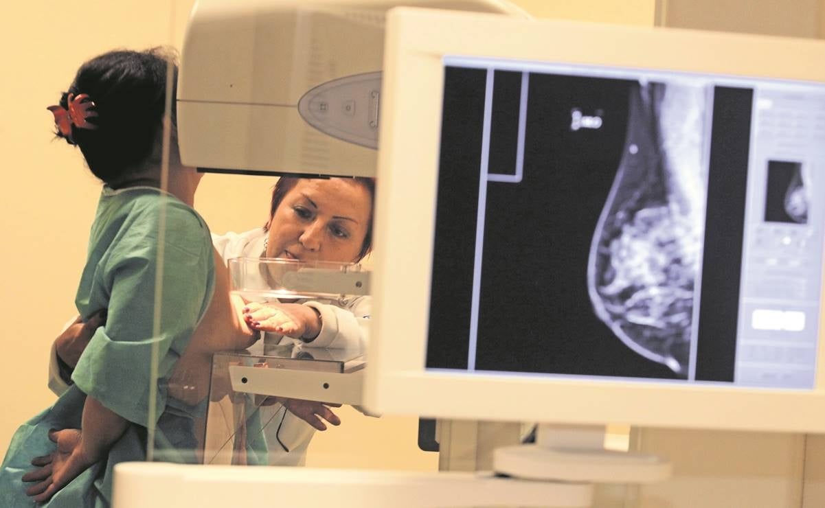UASLP trabaja en proyecto de detección inmediata de cáncer de mama 